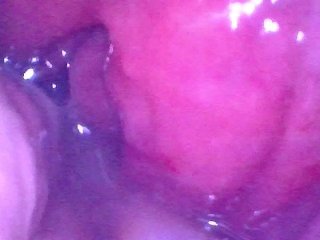 Endoscope inside POV of my juicy Ass getting fisted deeply Preview