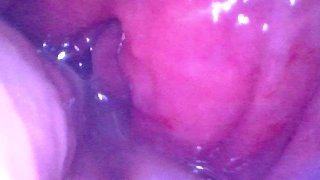 Endoscope Inside POV Of My Juicy Ass Getting Fisted Deeply Preview