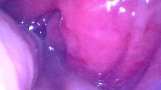 Endoscopio dentro de POV de mi jugoso culo recibiendo puño profundamente - Vista previa