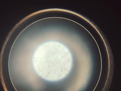 My sperm under microscope again :)