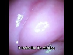 【膣壁映像】Twitterのフォロワーさんからプレゼントして頂いたカメラ付き小型バイブで、膣壁を撮影しました。