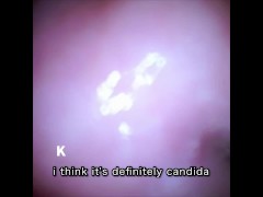 【膣壁映像】Twitterのフォロワーさんからプレゼントして頂いたカメラ付き小型バイブで、膣壁を撮影しました。 - Screenshot 13 of 16 - Small Camera