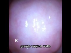 【膣壁映像】Twitterのフォロワーさんからプレゼントして頂いたカメラ付き小型バイブで、膣壁を撮影しました。 - Screenshot 4 of 16 - Vaginal Wall