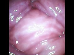 【膣壁映像】Twitterのフォロワーさんからプレゼントして頂いたカメラ付き小型バイブで、膣壁を撮影しました。 - Screenshot 8 of 16 - Small Camera