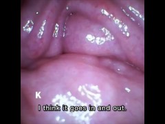 【膣壁映像】Twitterのフォロワーさんからプレゼントして頂いたカメラ付き小型バイブで、膣壁を撮影しました。 - Screenshot 9 of 16 - Vaginal Wall