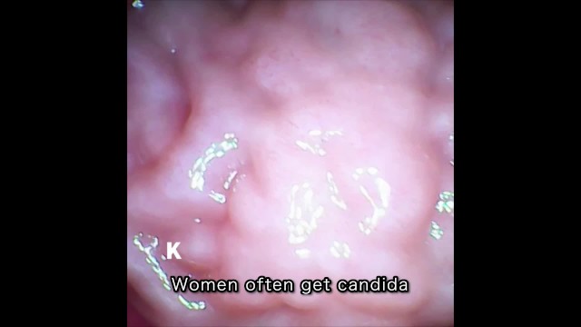 [Vaginal wall video] I took a picture of the vaginal wall with a ...