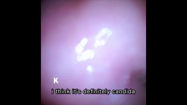 [Vaginal wall video] I took a picture of the vaginal wall with a ...