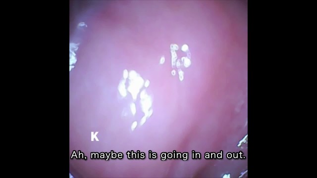 [Vaginal wall video] I took a picture of the vaginal wall with a ...