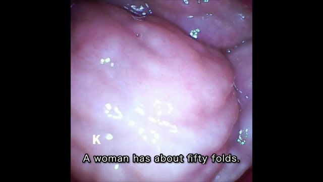 [Vaginal wall video] I took a picture of the vaginal wall with a ...
