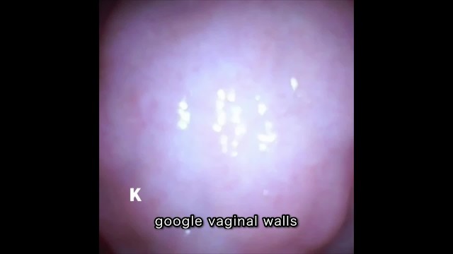 [Vaginal wall video] I took a picture of the vaginal wall with a ...