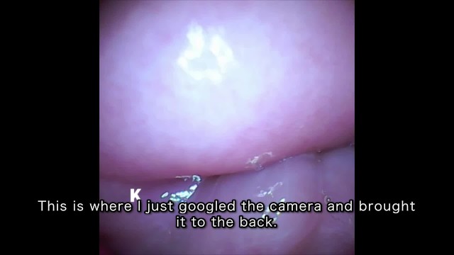 [Vaginal wall video] I took a picture of the vaginal wall with a ...