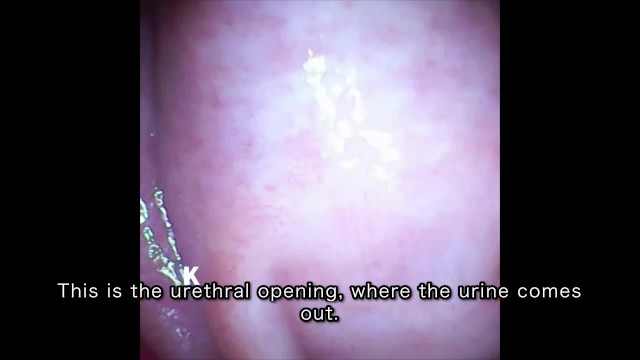 [Vaginal wall video] I took a picture of the vaginal wall with a ...