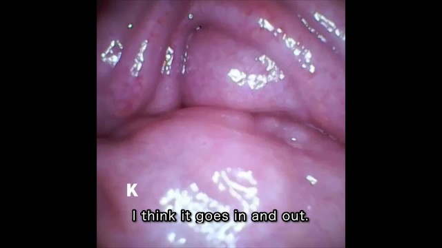 [Vaginal wall video] I took a picture of the vaginal wall with a ...