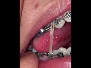 latina, solo female, braces, dentist