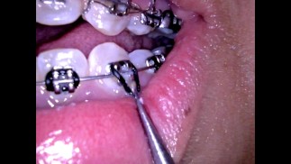 Посмотри, как я поправляю свои резинки🔥🤤