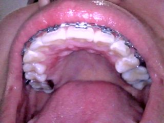 Mira todo el metal de mi boca y como te trago🤤👄