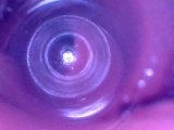 Endoscope Journey into My Deepest Intestines - Preview