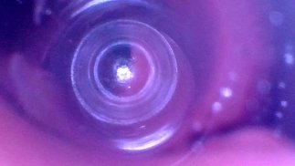 Endoscope Journey into My Deepest Intestines - Preview