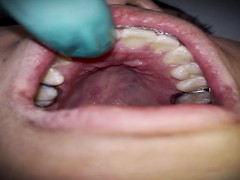 Touch my braces - Screenshot 16 of 16 - Braces