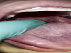 Gagging in the dentist