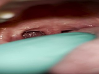 Рвотные позывы у стоматолога
