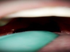 Exploring my mouth with braces (in the dentist)