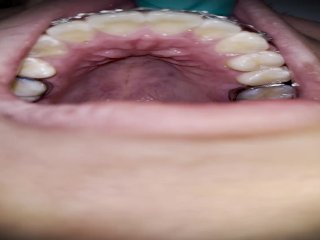 bukkake, dentista, casting, teeth