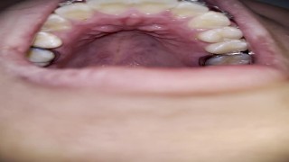 Explorando minha boca com aparelho (no dentista)