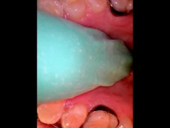 Mouth tour with braces