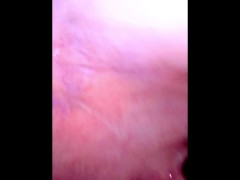 My uvula - Screenshot 10 of 16 - Dentist