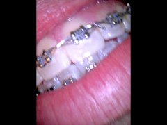 Vore video - Screenshot 1 of 16 - Braces