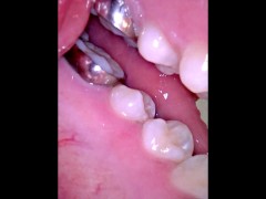 Vore video - Screenshot 11 of 16 - Braces