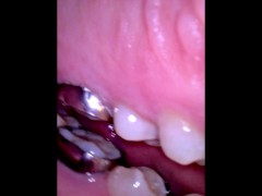 Vore video - Screenshot 13 of 16 - Latina Braces