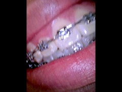 Vore video - Screenshot 2 of 16 - Girl With Braces