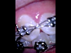 Vore video - Screenshot 3 of 16 - Latina Braces