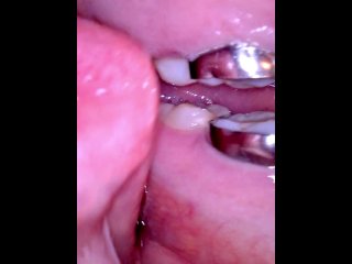 uvula, girl with braces, fetish, solo female