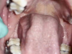 Uvula fetish - Screenshot 10 of 16 - Mouth Fetish