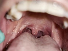 Uvula fetish