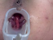 Preview 5 of Anal speculum and squirt ( censured version)