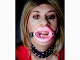Open mouth lip gag and braces fetish featuring Alexandra Braces