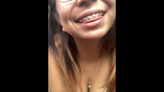 Braces JOI