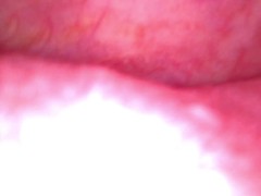 Inside my mouth with braces