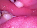 Inside my mouth with braces