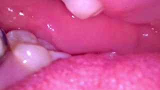Dentro la mia bocca con l'apparecchio ortodontico