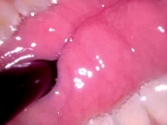 Can you check my braces?