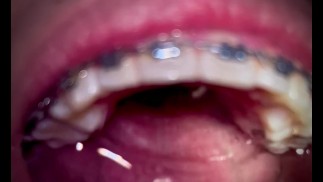 Open mouth