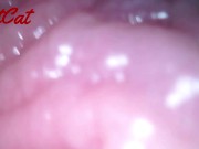 Preview 1 of Endoscopic ♥vaginal observation