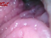 Preview 2 of Endoscopic ♥vaginal observation