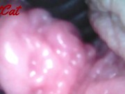 Preview 3 of Endoscopic ♥vaginal observation