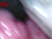 Preview 4 of Endoscopic ♥vaginal observation